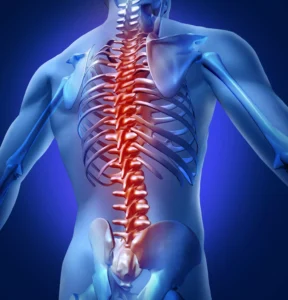 3D Medical Illustration Of A Translucent Blue Human Torso With A Highlighted Red Spine, Representing Spinal Trauma Evaluated By A Dallas Spinal Cord Injury Attorney.
