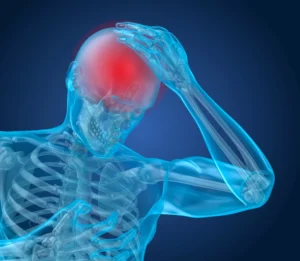 Dallas Car Crash Concussion Lawyer Mri Image