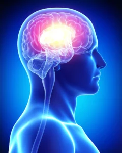 Medical Illustration Highlighting Brain Trauma Used By A Dallas Traumatic Brain Injury Lawyer To Explain The Effects Of A Tbi.